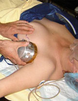 Breast Clinic Cancer Surgery Clinic Breast Clinic Cancer Surgery Clinic