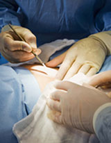 Natural Remedies after Cancer Surgery Natural Remedies after Cancer Surgery